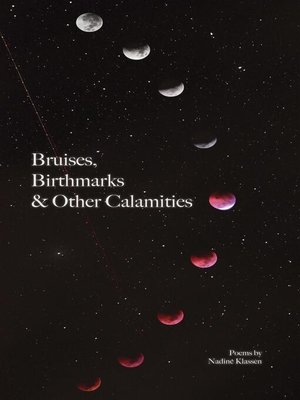 cover image of Bruises, Birthmarks & Other Calamities